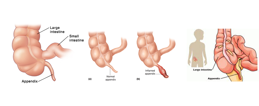 Appendix